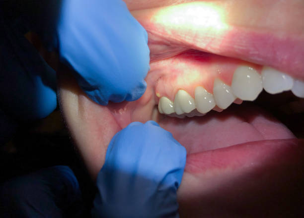 Best Walk-In Emergency Dental Services in Jackson, SC