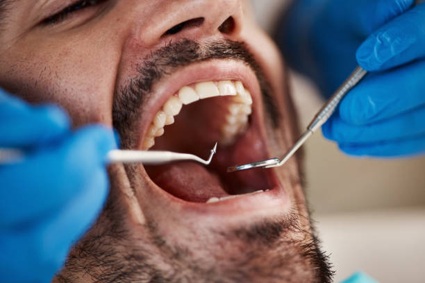 Best Emergency Dental Care for Sports Injuries in Jackson, SC