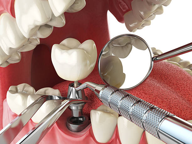 Best Broken or Chipped Tooth Repair in Jackson, SC